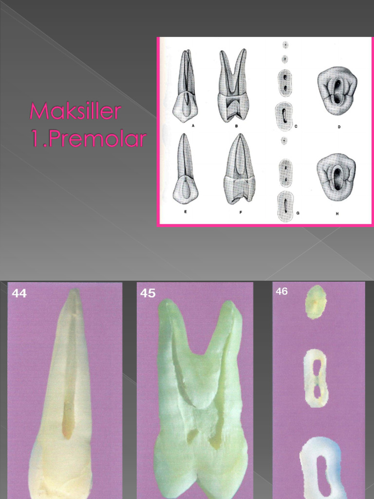 8-premolar-access-cavity-2-pdf