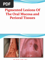 melanotic macule icd 10 Pathology Outlines main image 1