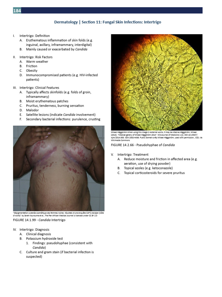 Section 11 - Fungal Skin Infections - Intertrigo | PDF | Candidiasis ...