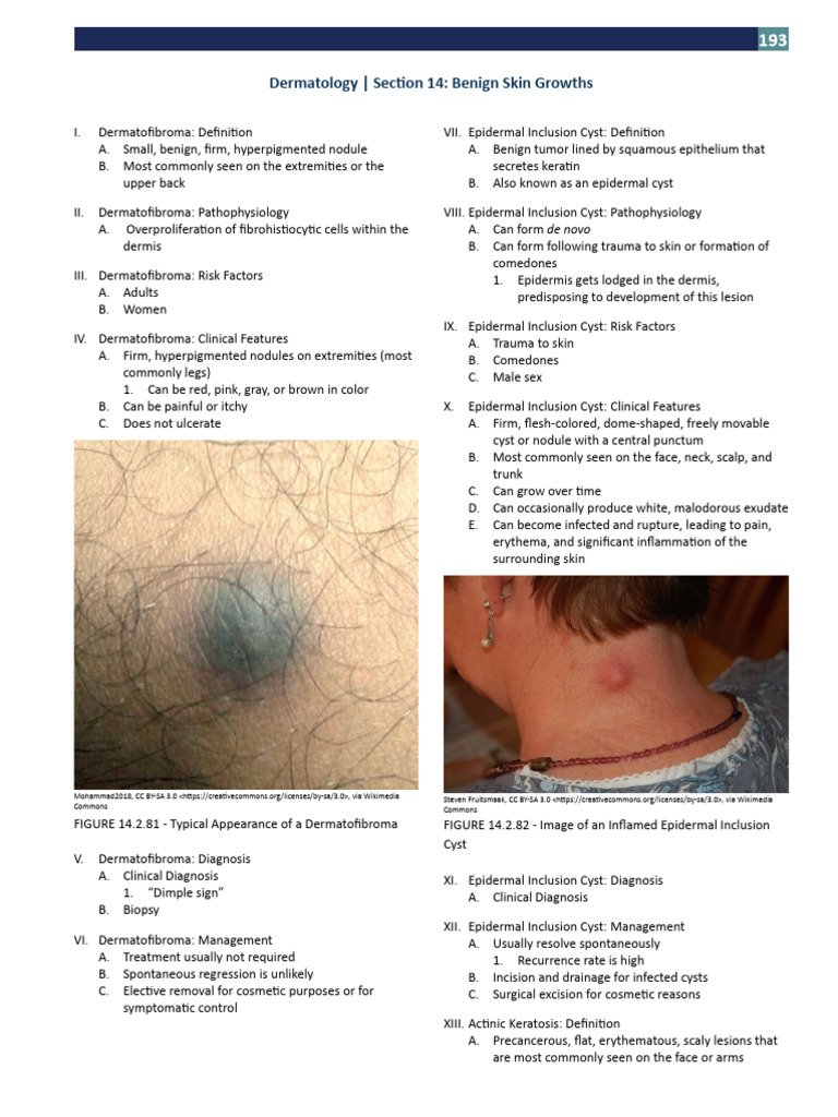 Benign Skin Growths: Types & Management | PDF | Epidermis | Medical ...