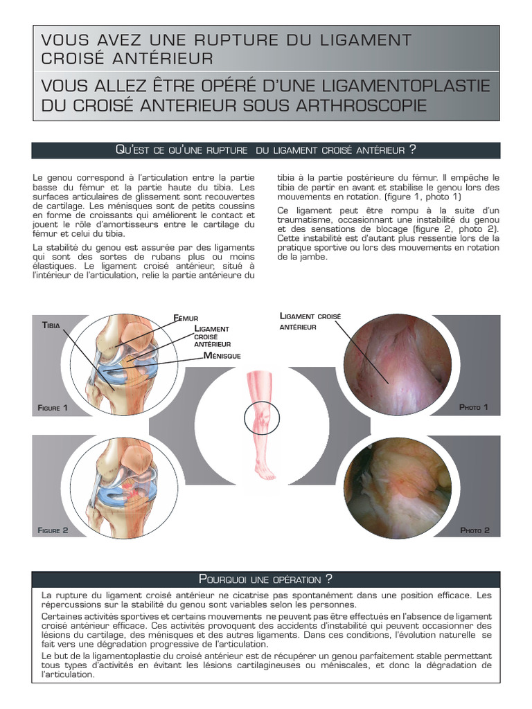 Ligamentoplastie du croisé antérieur Guide PDF Genou Appareil — free download