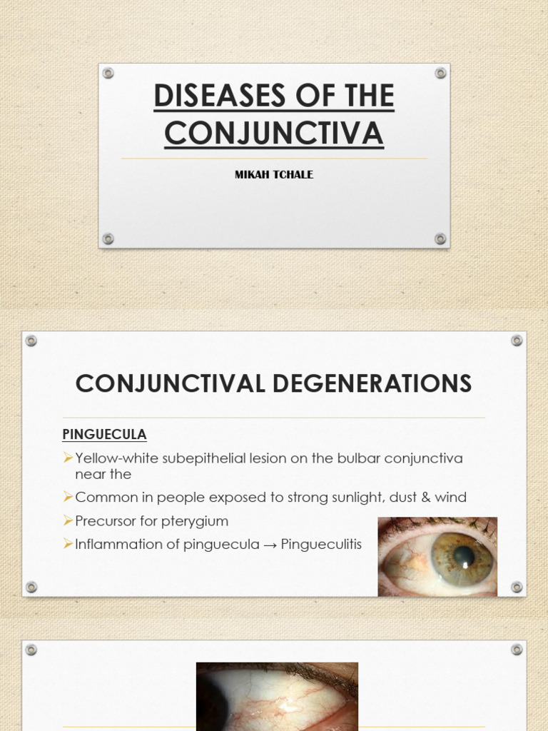 Conjunctival Diseases and Treatments Guide | PDF | Diseases And ...