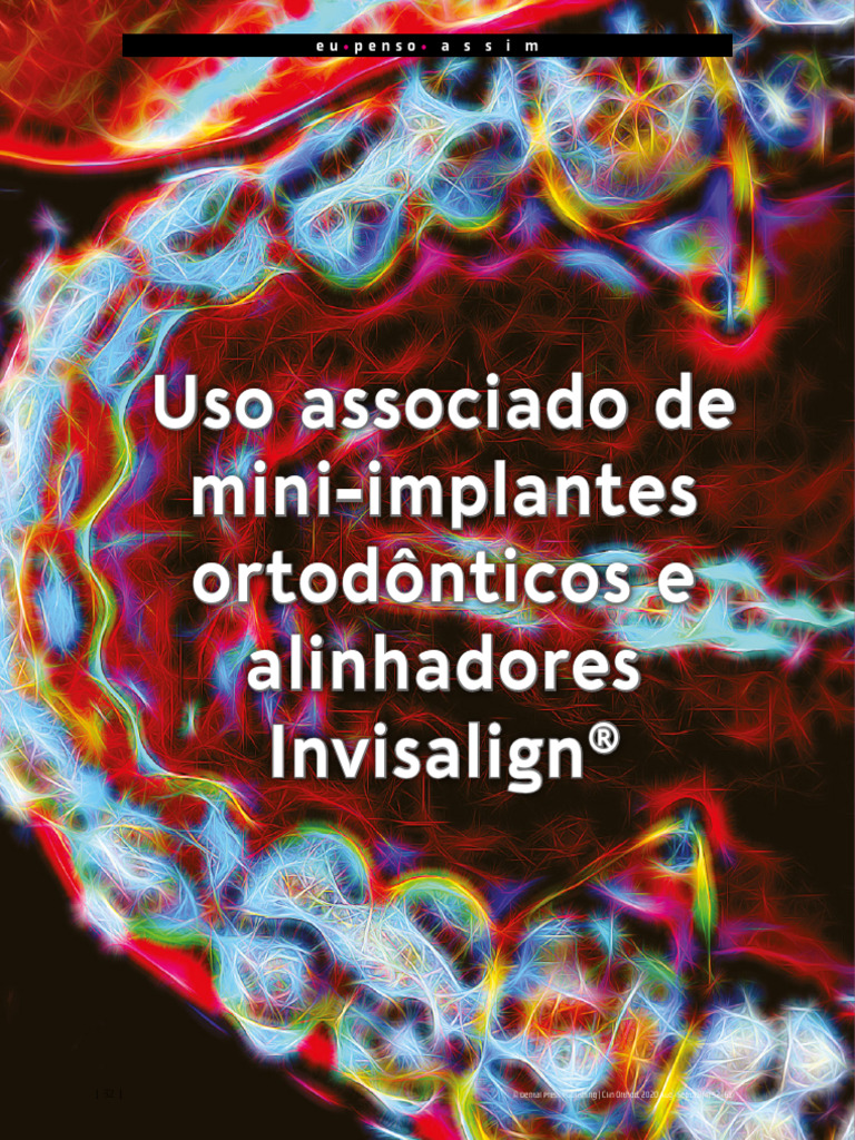 Mini-implantes e Alinhadores Invisalign® | PDF | Dente humano | Áreas ...