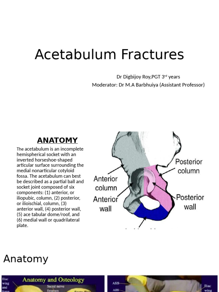 Acetabulum Fracture Classification | PDF | Pelvis | Anatomical Terms Of ...