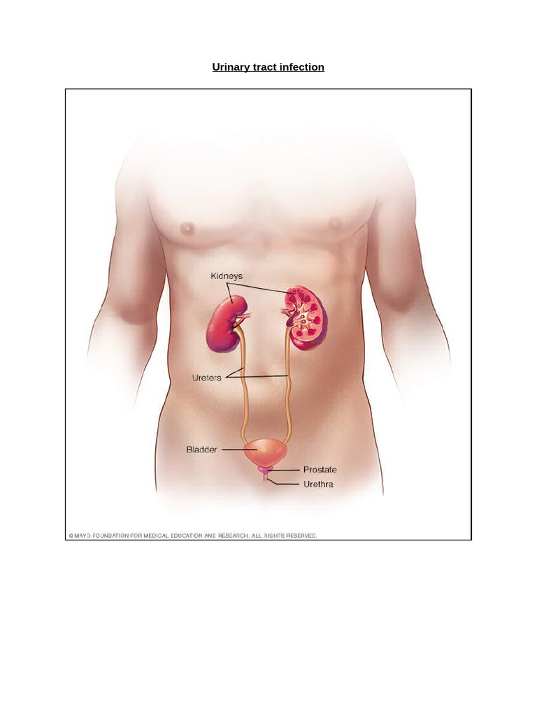 Understanding Urinary Tract Infections (UTIs) | PDF