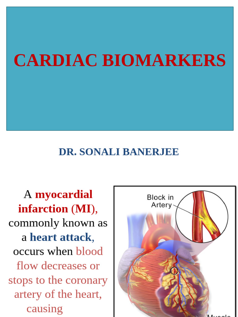 Understanding Cardiac Biomarkers | PDF | Myocardial Infarction ...