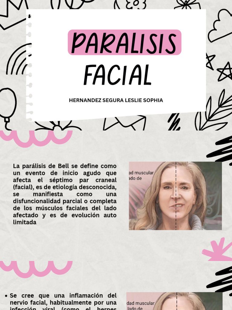 Paralisis Facial | PDF | Masaje | Especialidades Medicas