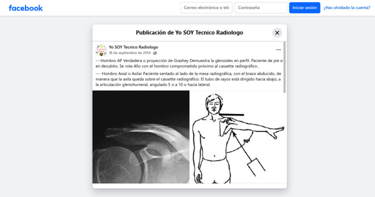 Proyección AP Verdadera de Hombro | PDF