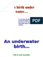 Water Birth