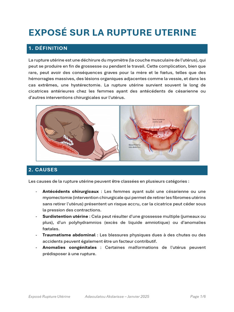 Syndrome Pré-Rupture Utérine | PDF | Grossesse | Utérus