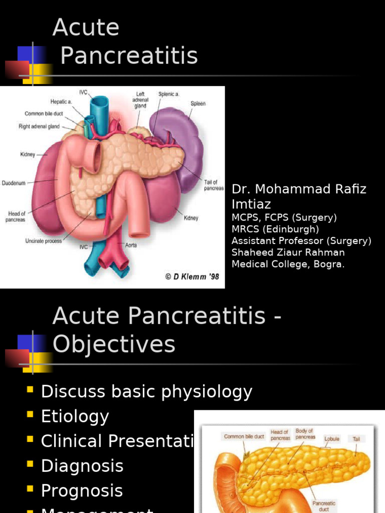 Understanding Acute Pancreatitis | PDF | Pancreas | Medical Specialties