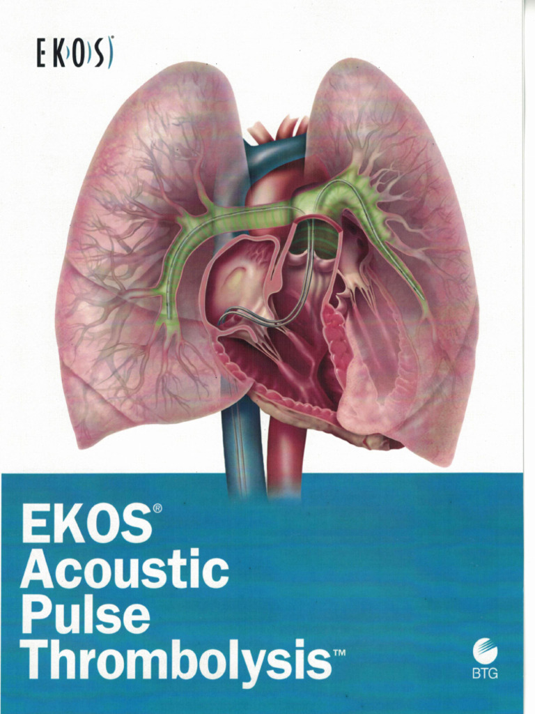 Ekos 1 | PDF