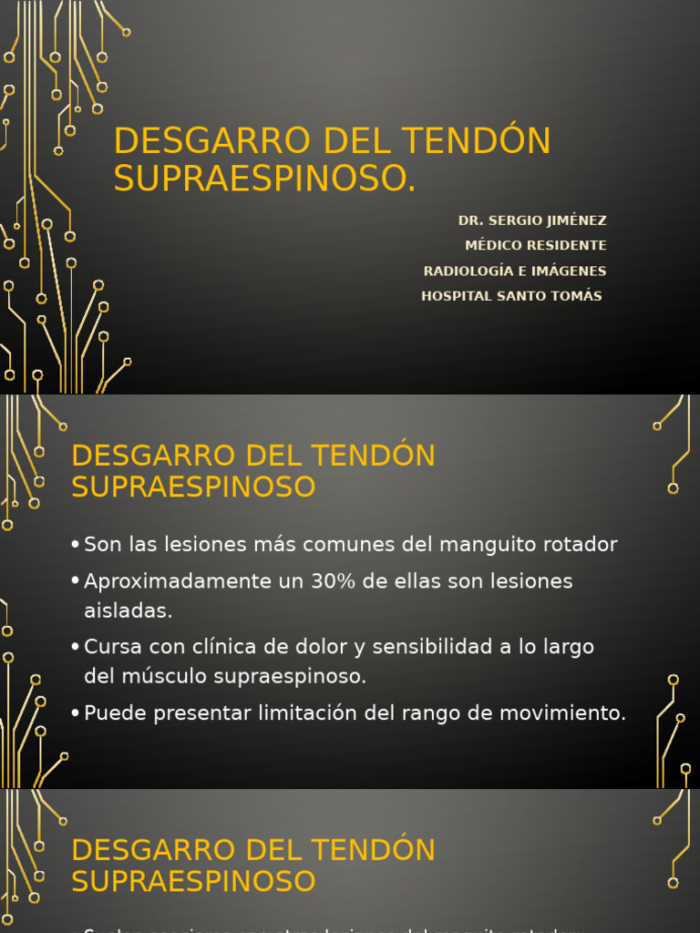 desgarro-del-tend-n-supraespinoso-pdf