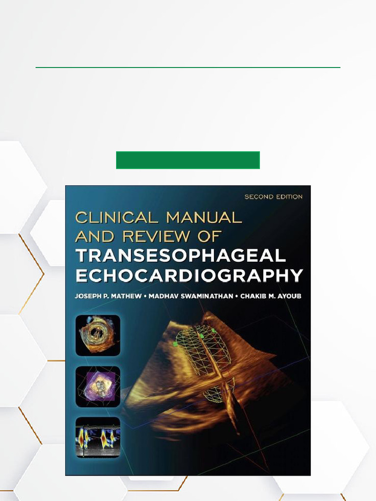Get Clinical Manual and Review of Transesophageal Echocardiography