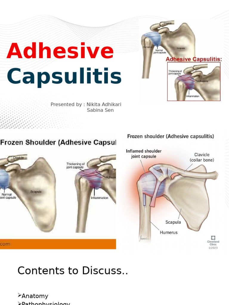 Understanding Adhesive Capsulitis | PDF | Shoulder | Medical Specialties