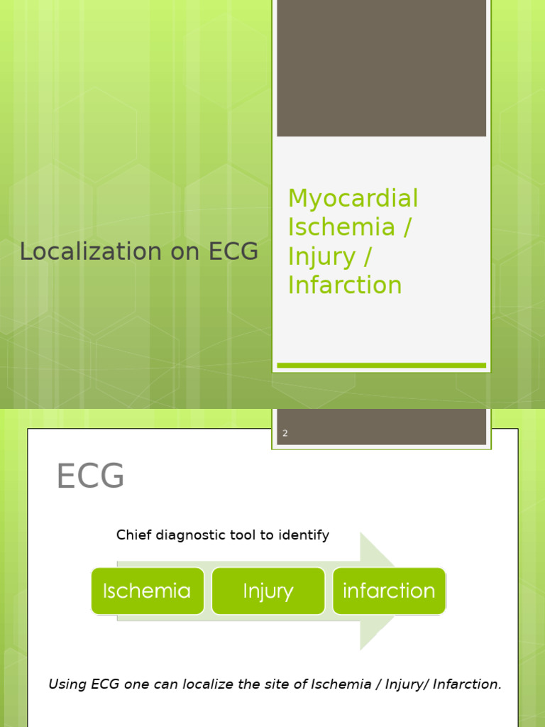 ECG Localization in Myocardial Infarction | PDF | Coronary Circulation ...