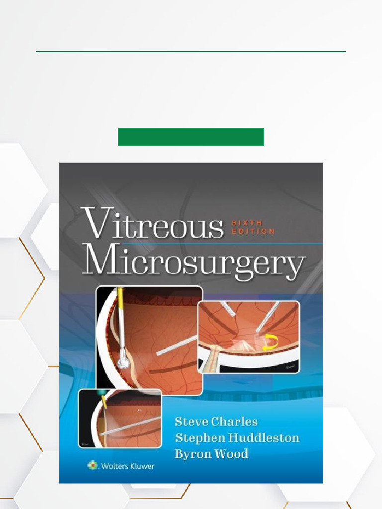 Vitreous Microsurgery 6th Edition Authorized Download | PDF