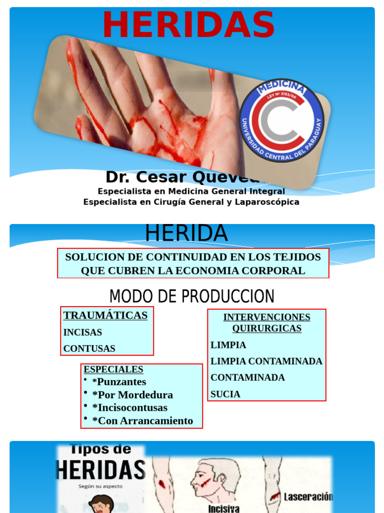 Clasificación y Primeros Auxilios de Heridas | PDF | Herida | Primeros ...