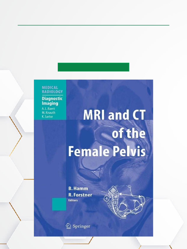 MRI and CT of The Female Pelvis, 1st Edition Entire Book Download | PDF