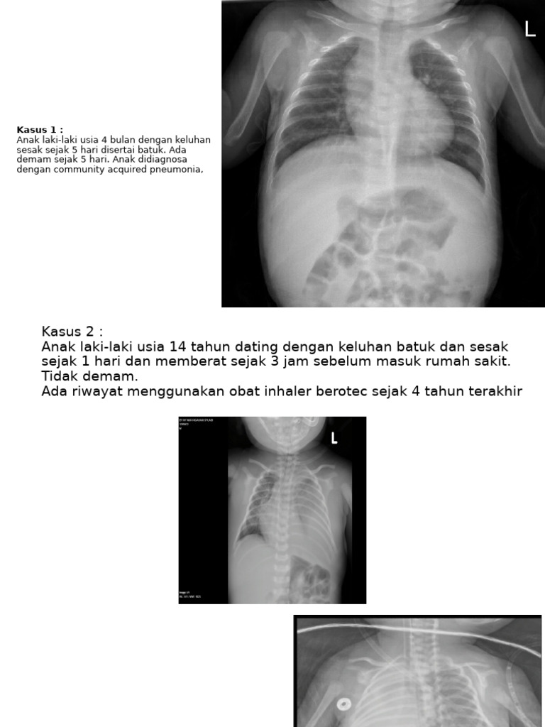 Example For Radiology | PDF