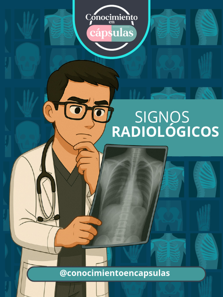 Radiológicos: Signos | PDF | Pulmón | Medicina CLINICA