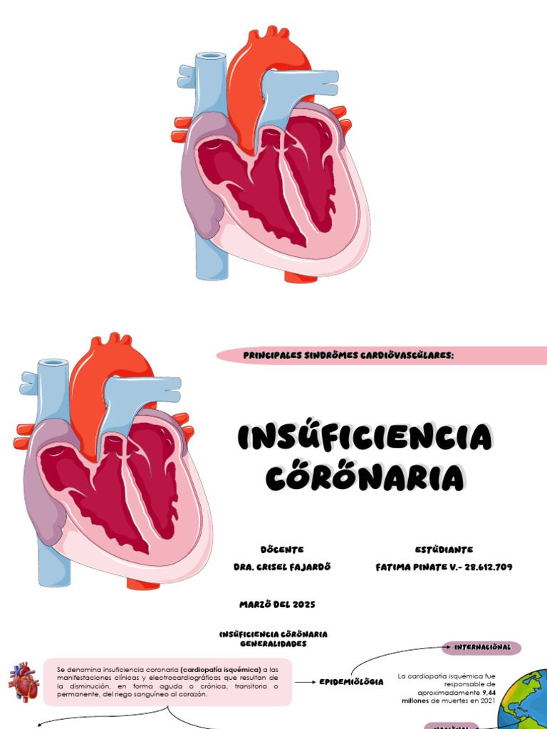 Síndromes Cardiovasculares: Insuficiencia Coronaria | PDF | Infarto de ...