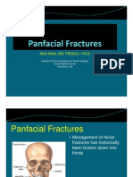 Management of Panfacial Fractures