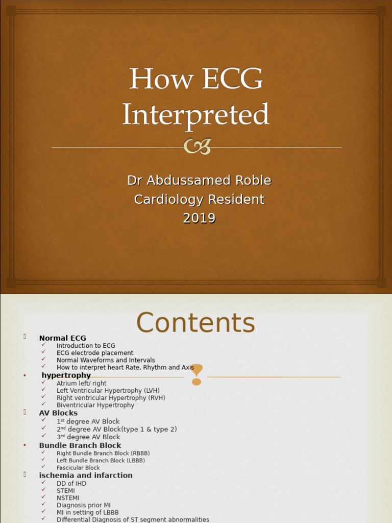 Comprehensive ECG Interpretation Guide | PDF | Electrocardiography ...