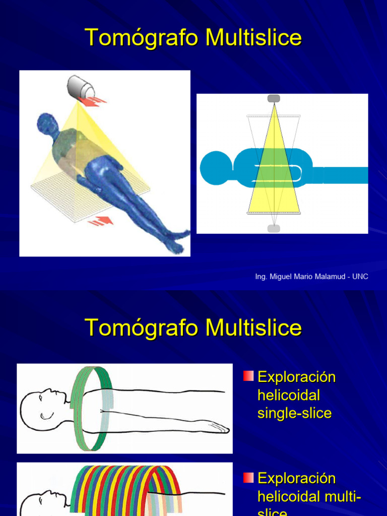 Tomografía Multislice: Funcionamiento y Tipos | PDF