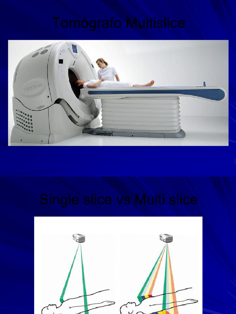 Tomógrafo Multislice: Comparativa y Funciones | PDF