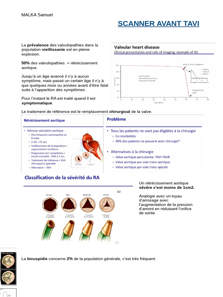 Scanner TAVI : Évaluation du rétrécissement aortique | PDF | Aorte ...