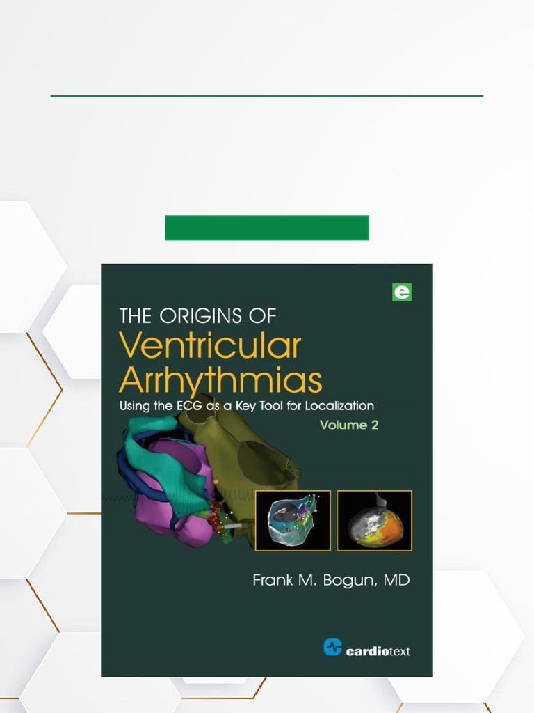ECG Insights on Ventricular Arrhythmias | PDF | Heart | Electrocardiography