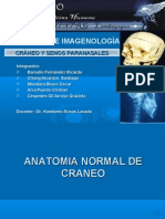 Radioanatomia de Cráneo y Senos Paranasales