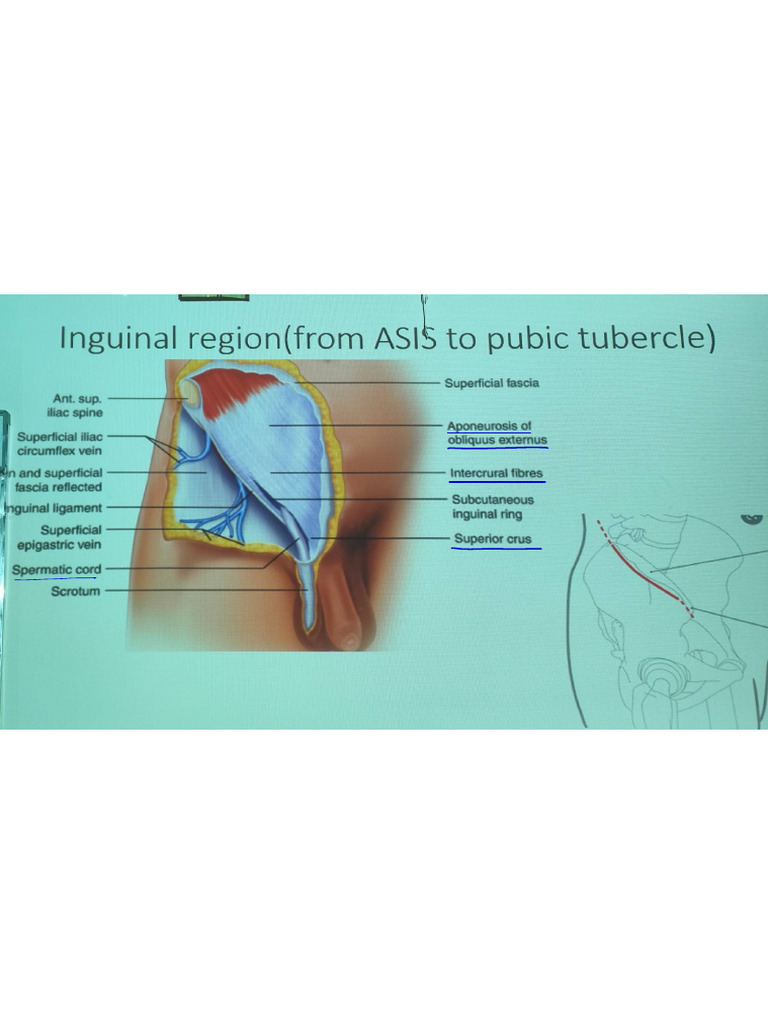 Groin Anatomy and Orchiopexy Overview | PDF