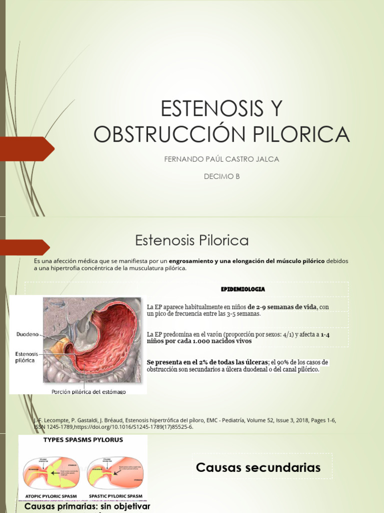 Estenosis y Obstrucción Pilórica | PDF | Cáncer | Enfermedades y trastornos