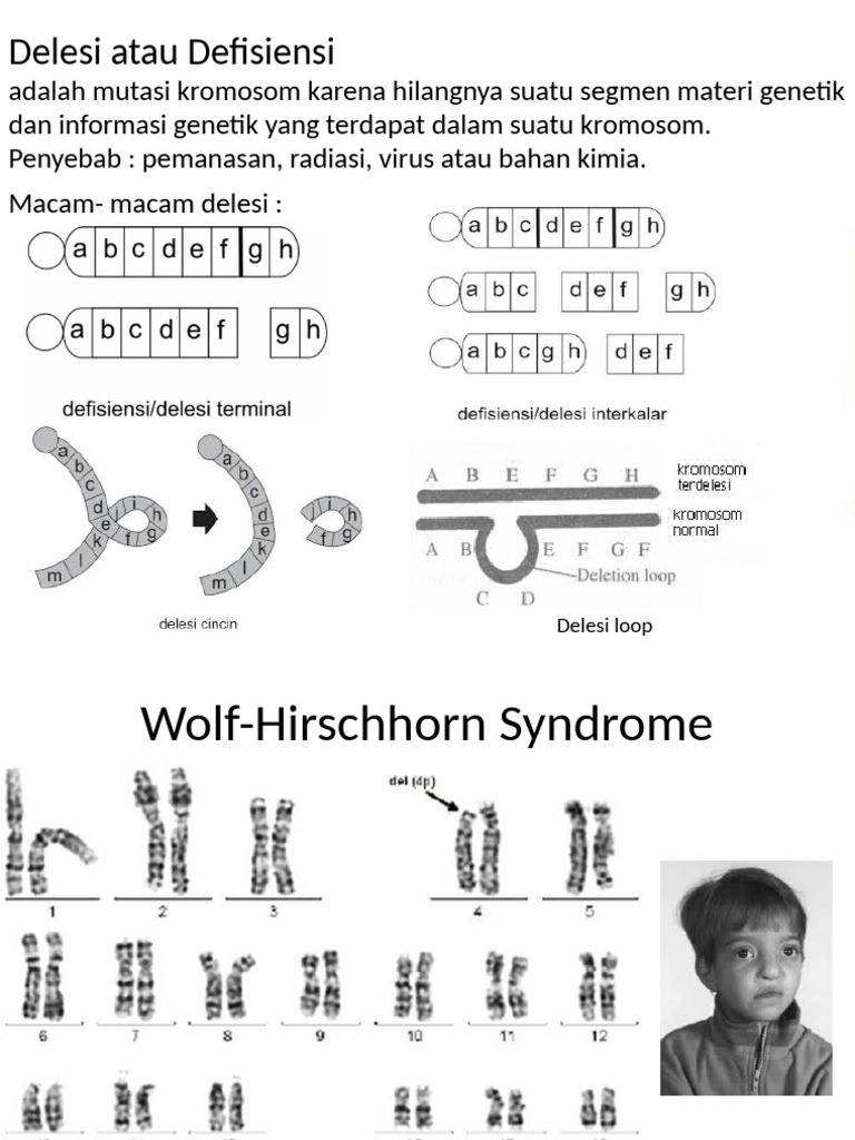 Delesi Atau Defisiensi Mutasi Kromosom | PDF
