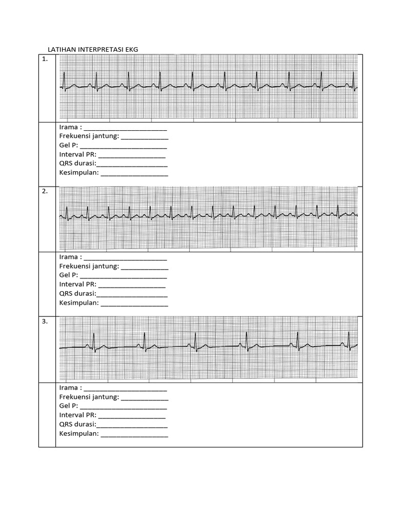 EKG Interpretation Practice Guide | PDF | Electrocardiography ...