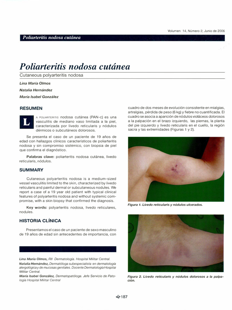 Poliarteritis Nodosa Cutánea: Caso Clínico | PDF | Hepatitis | Hepatitis B