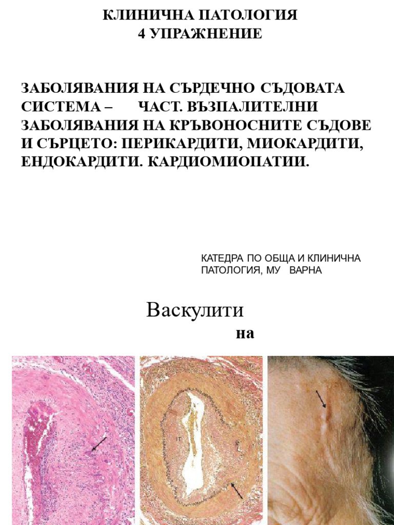 ClinPath 4 III Cardites | PDF