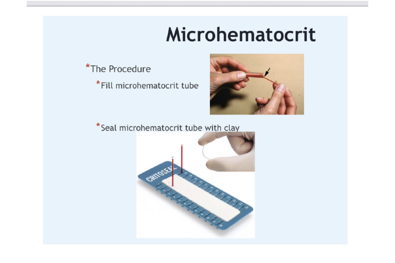 Microhematocrit Procedure | PDF