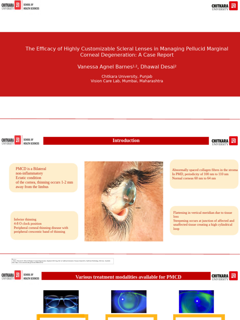 Custom Scleral Lenses for PMCD Management | PDF | Cornea | Ophthalmology