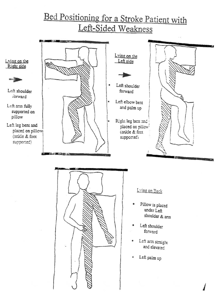 Bed Positioning For Stroke Patients | PDF