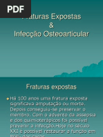 Fraturas_Expostas