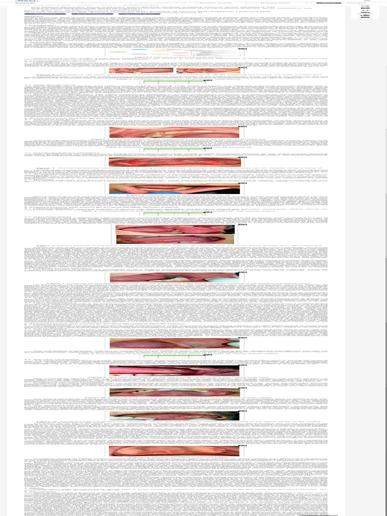 Decision Tree for Oral White Lesions | PDF | Diseases And Disorders ...