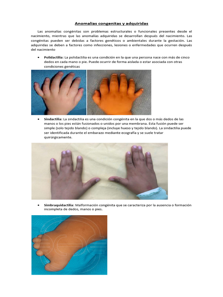 anomal-as-cong-nitas-y-toma-de-huellas-pdf-huella-dactilar-mano