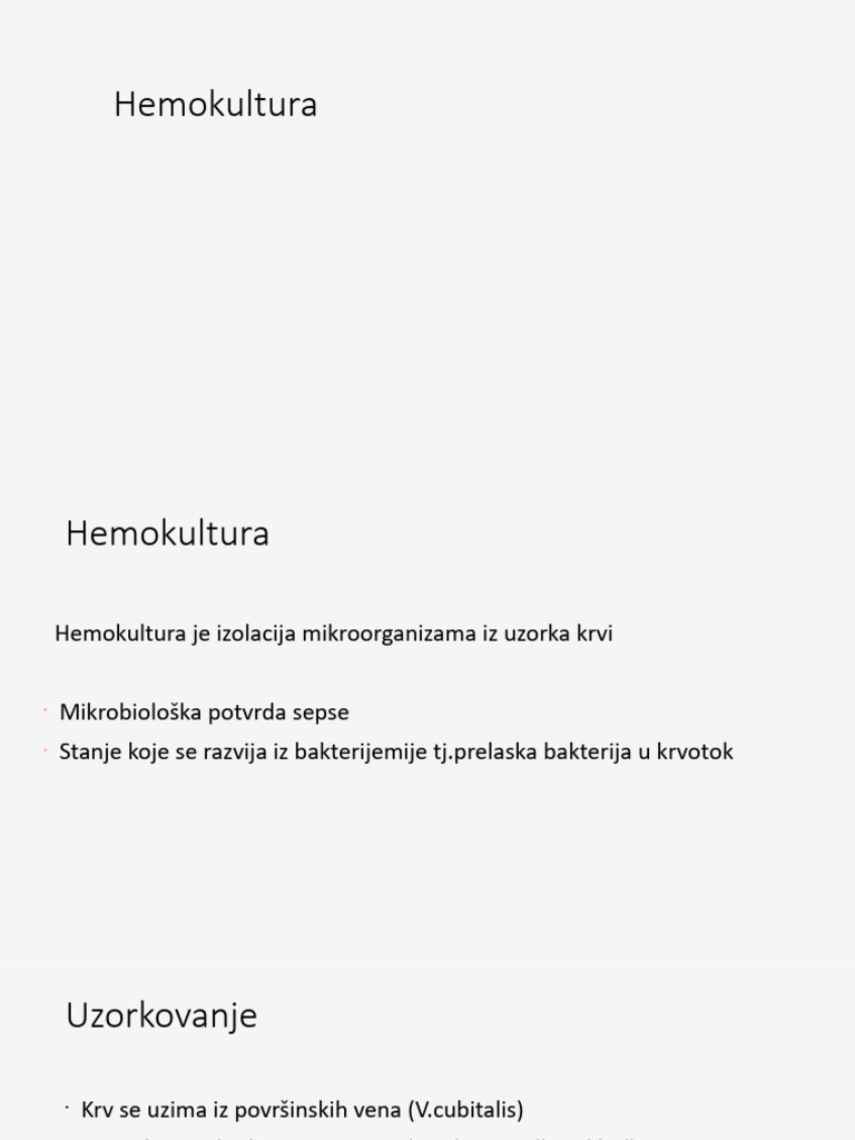 Zlo Proljece | PDF