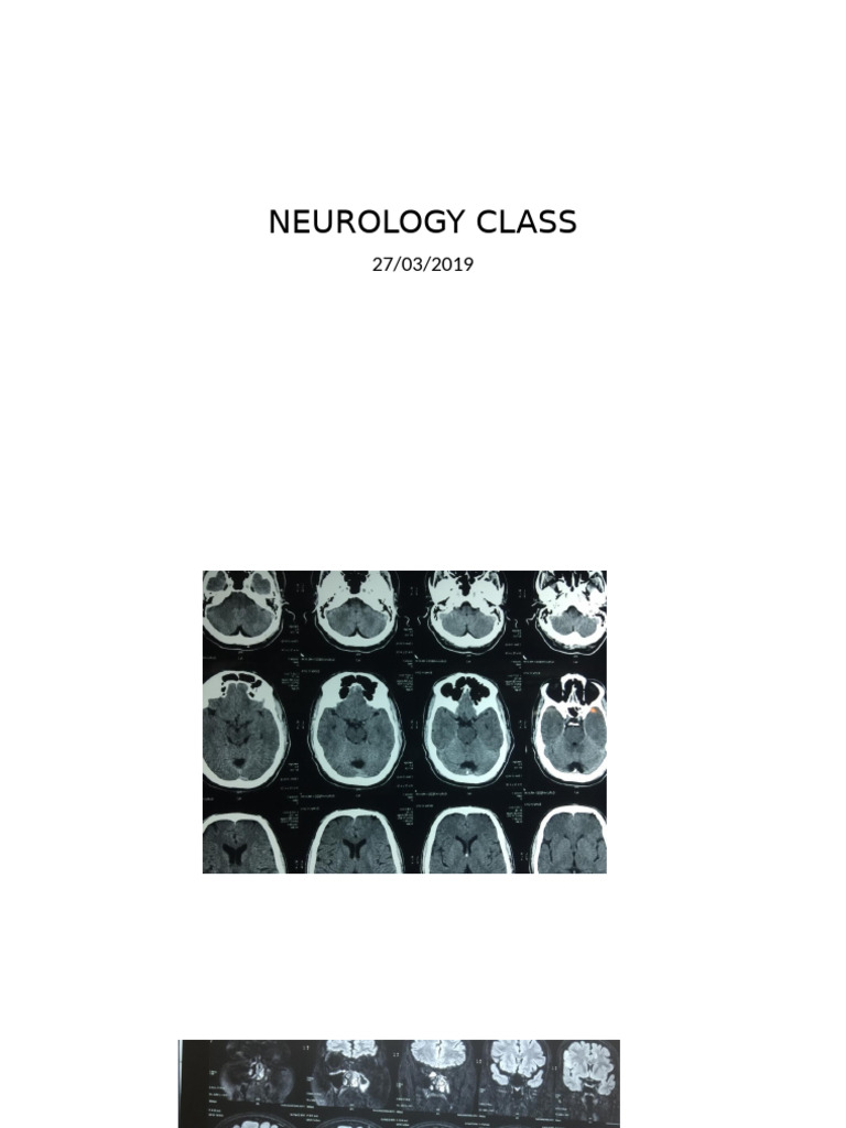 Neurology Class 27th March | PDF