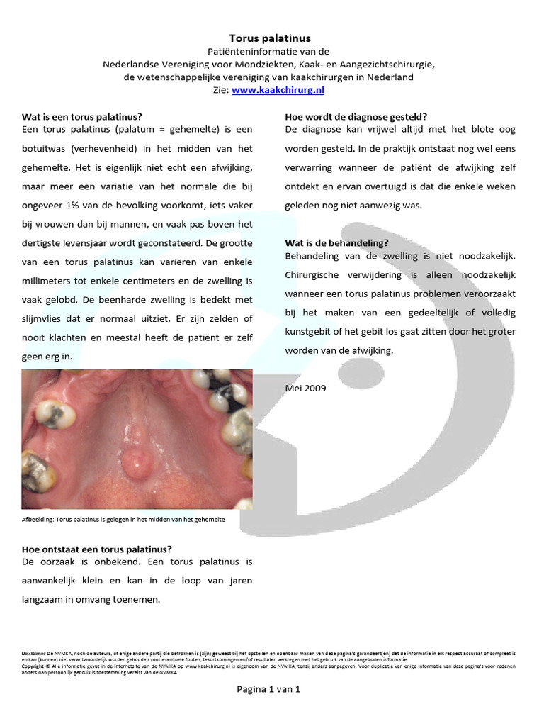 Torus Palatinus | PDF