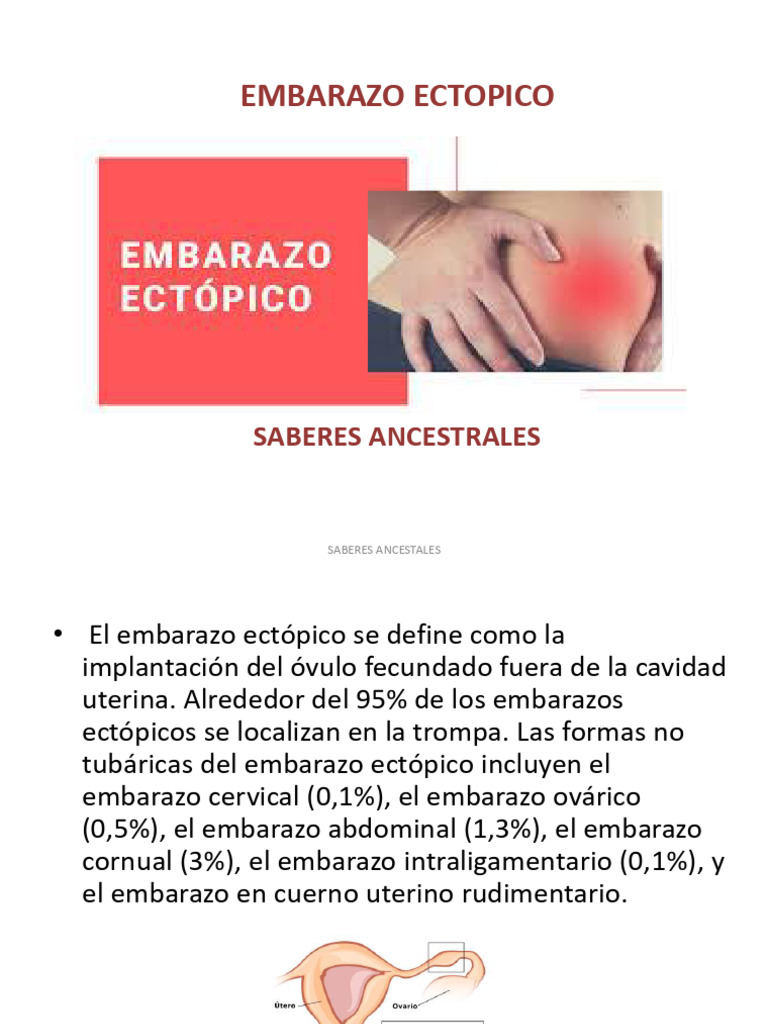 Embarazo Ectopico | PDF | El embarazo | Embarazo humano