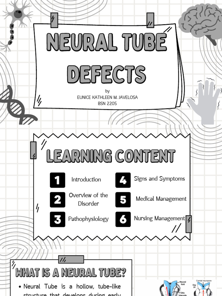 Neural Tube Defects Javelosa 05 | PDF | Neuroscience | Medical Specialties